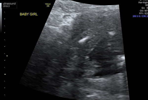 Gender scan photos, what do you think!