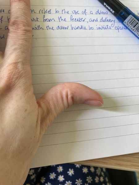 Is my thumb weird?
