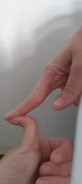 Is my thumb weird?