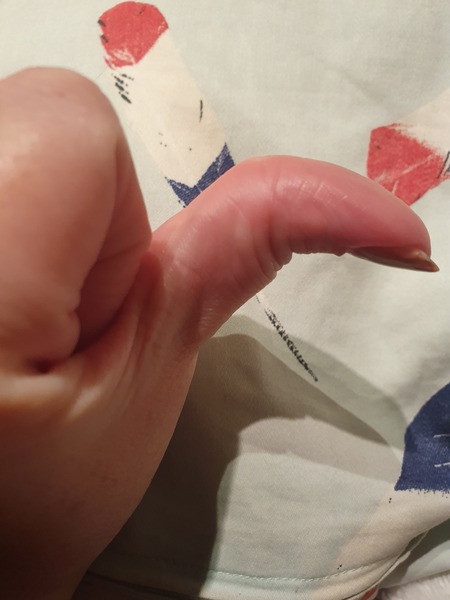 Is my thumb weird?
