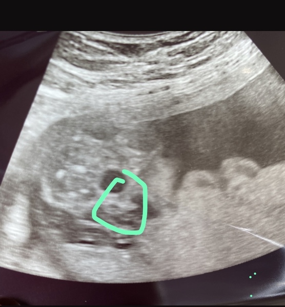 Gender Confusion Help!