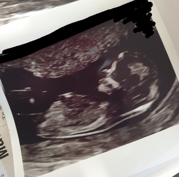 March 2021 #4