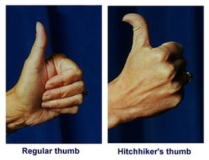 Is my thumb weird?