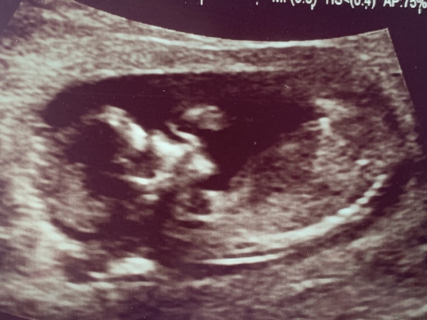 March 2021 #3