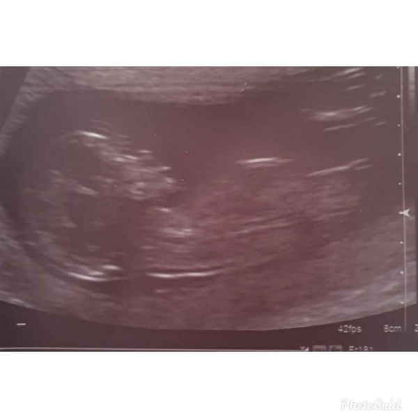 OK guys Super excited! 12 week scan