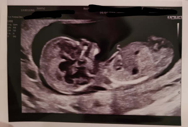 March 2021 #3