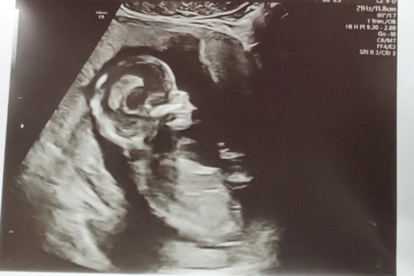 Any gender guesses ? 14+2 x
