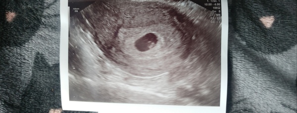 Conception:  TTC Baby no1. The crazy lot. Thread 3!!!