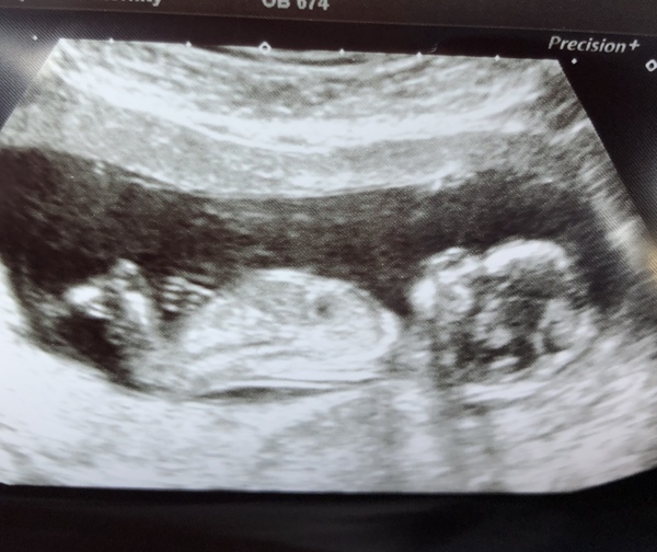 March 2021 #3
