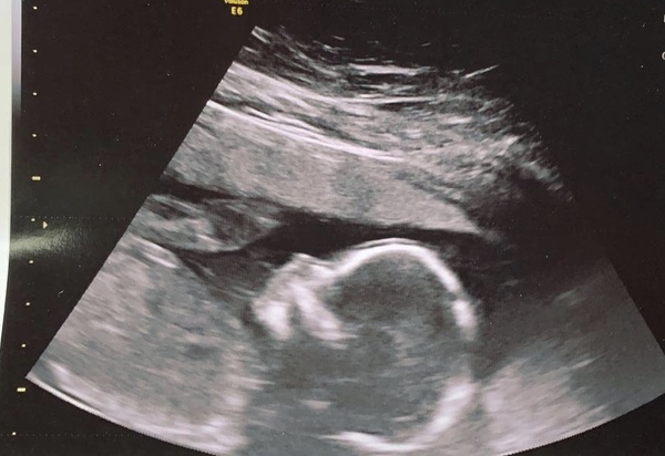 Any guesses boy or girl?