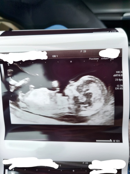 March 2021 #3