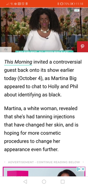 Jesica Krug - white Jewish Woman pretended to be black.