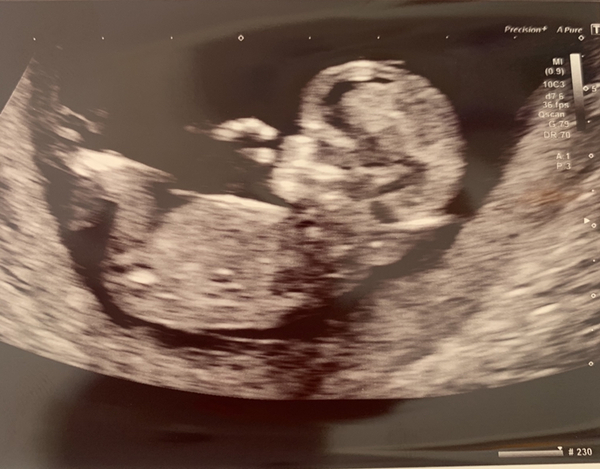 Old ovaries, new lines