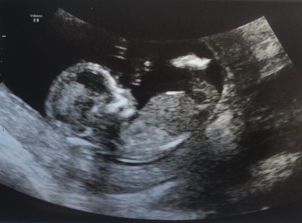 March 2021 #4