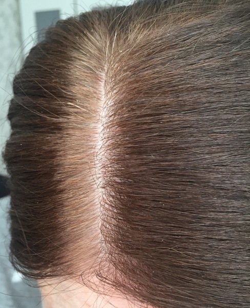 Let my natural colour come through? Pics