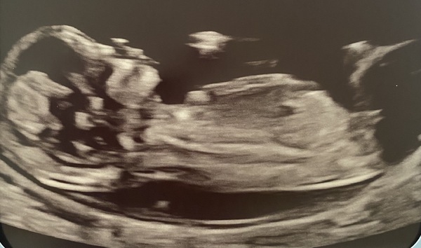 Boy or Girl? Guesses please! 💙💗