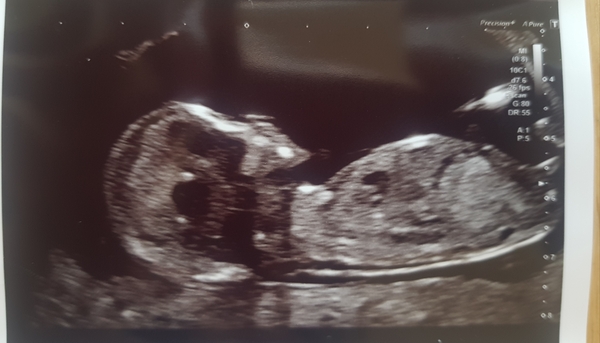 March 2021 #4