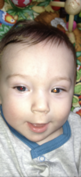 Colour of eye pupil in photos