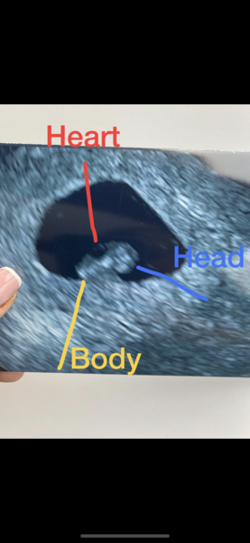 Tracking your cycle and possible BFP using RHR - part 3
