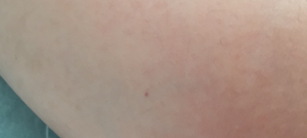 To ask what this Mark/spot looks like