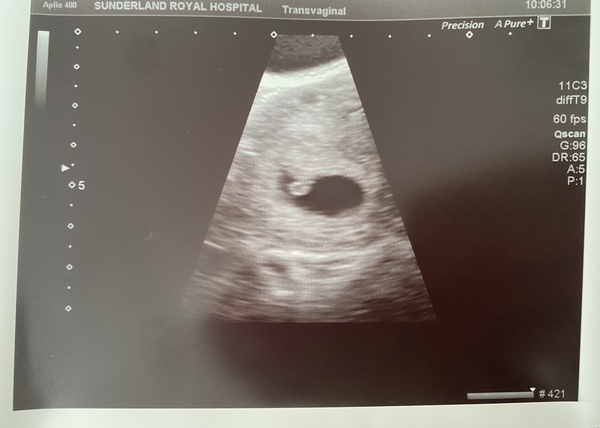 Ladies in very early pregnancy.. want to hear your first few weeks after BFP stories!