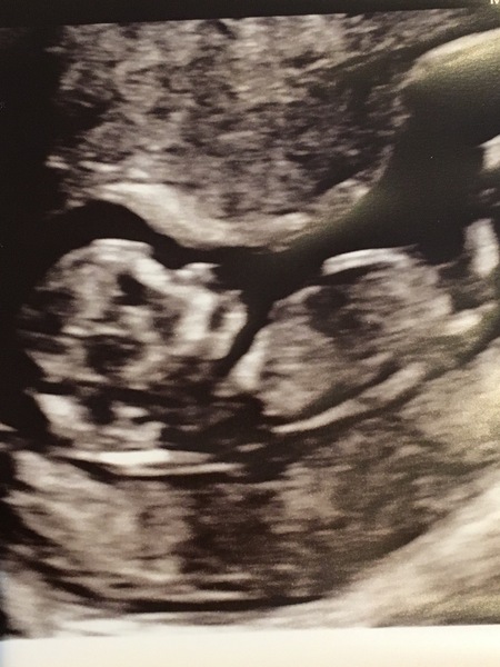 March 2021 #4