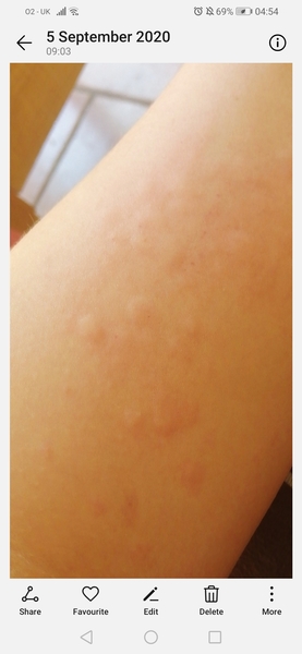 Bedbugs