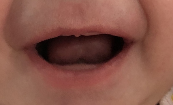 Is this really a tongue tie?