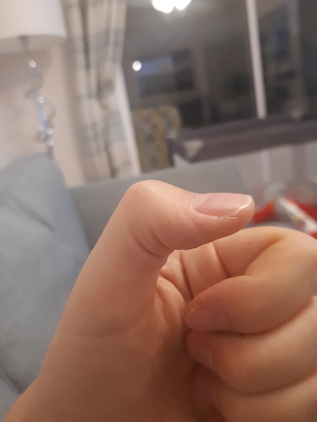 Is my thumb weird?