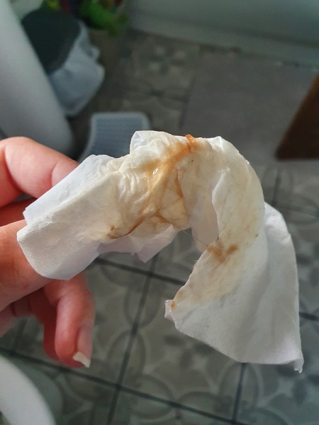 Mucus plug?! Pic warning