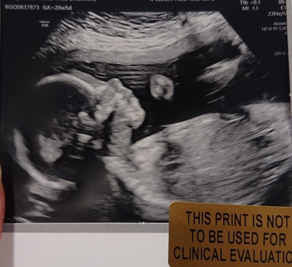Due January 2021!