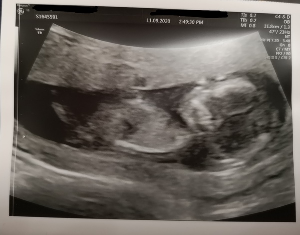 March 2021 #3