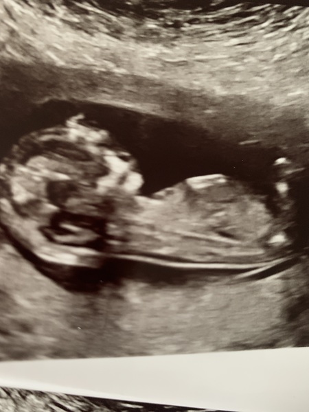 March 2021 #2