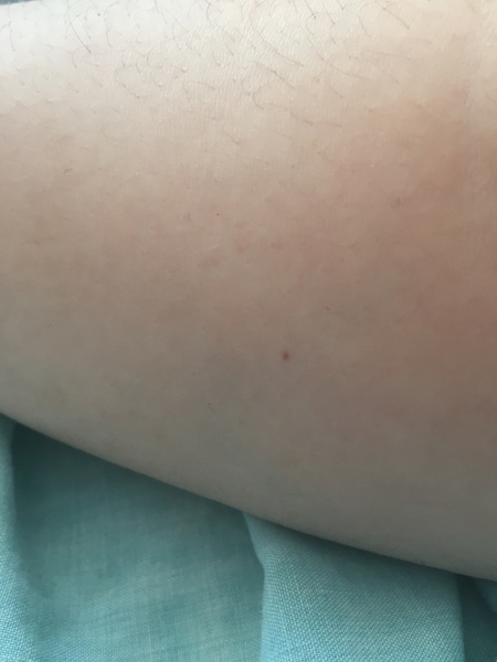 To ask what this Mark/spot looks like