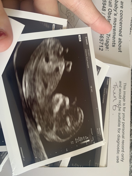 Gender guesses?!