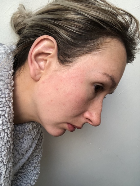 Help with skincare regime? Pics attached.