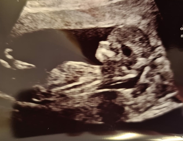March 2021 #3