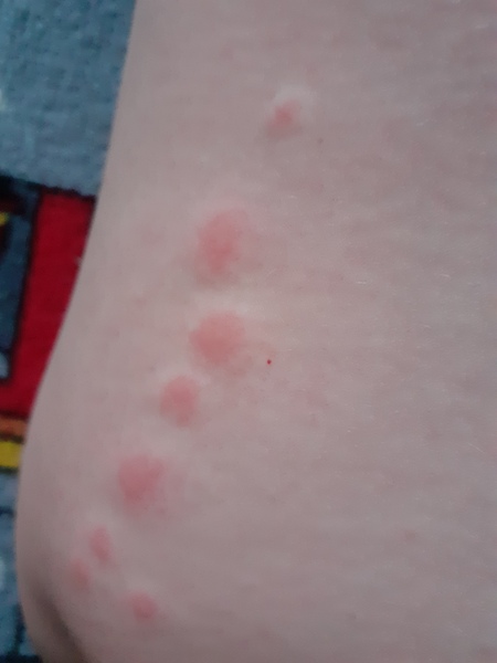 What are these lumps?!