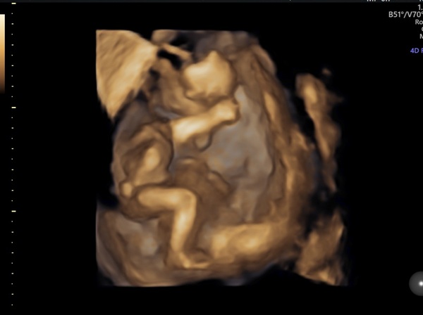 March 2021 #4