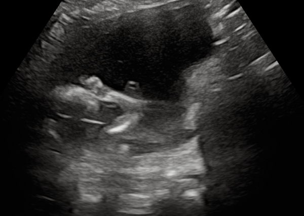 Anyone else due February 2021?