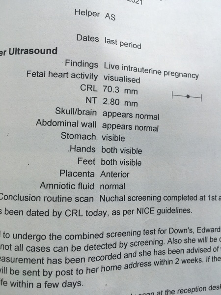 1.11 chances with NT 4.2
