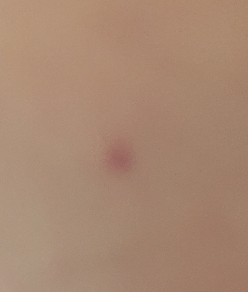 To ask what this Mark/spot looks like