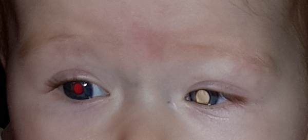 Colour of eye pupil in photos