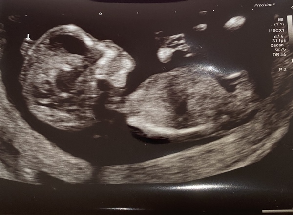 March 2021 #4
