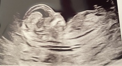 Gender guesses please