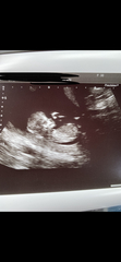 Girl or boy?! Finding out on Friday!