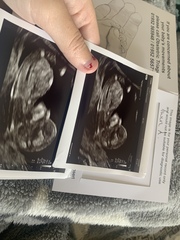 Twins gender guess?!