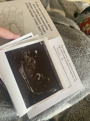 Gender guesses?!