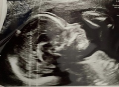 boy or girl guesses please? 20 weeks + 1 x