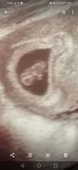 Early scan - What did you see?